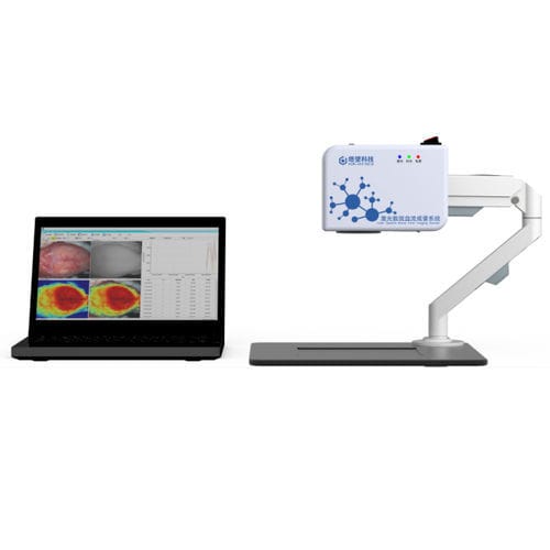 imager di flusso sanguigno - Shanghai TOW Intelligent Technology