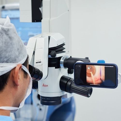 Adattatore per smartphone per lampada a fessura - MicroREC  - Custom Surgical