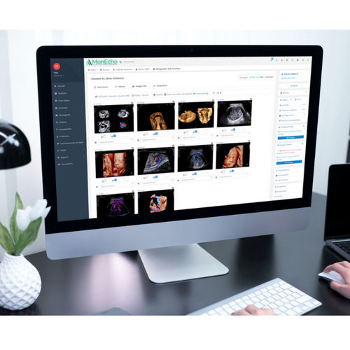 Software per ecografia - MONECHO - MonEcho - per ambulatorio / per ospedale / per ECG