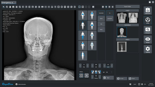Modulo software di analisi delle immagini - RayinView - Astel - di visualizzazione DICOM / di registrazione video / d’importazione