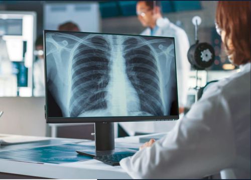 Software diagnostico - VUNO Med®-Chest X-ray™ - VUNO - di valutazione / per radiografia / di polmone