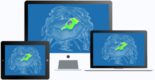 Software chirurgico - diSplay - InSimo - medico / clinico / di anatomia