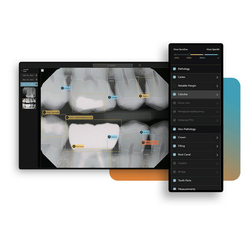 Piattaforma AI per radiografia dentale - Second Opinion® - Pearl - di analisi delle immagini