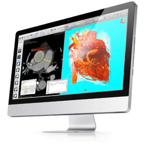 Software SPECT - Pixmeo SARL - visualizzatore / di post elaborazione / d’importazione