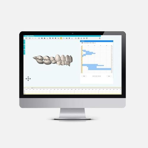 Software di analisi - DragonOrtho  - Innovative Material and Devices, Inc. - di pianificazione / di pianificazione del trattamento / di trattamento