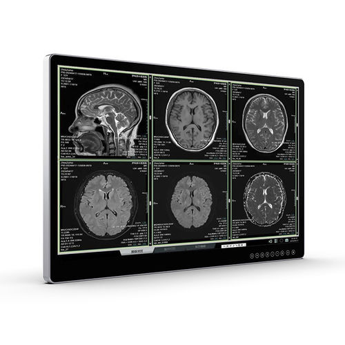 Monitor per diagnostica per immagini - UHD Surgical Monitor - Vecoton Technology - chirurgico / 4K / antiabbagliante