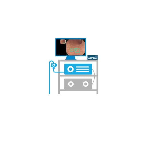Sistema di imaging endoscopico EUS - ASUS EndoAim - ASUS Computer International - broncoscopia / colonscopia