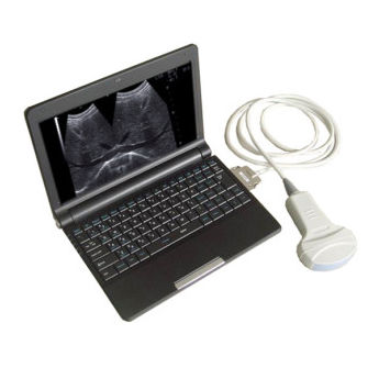 Ecografo per ecografia multidisciplinare - Arterial Doppler - Tianjin Guyufan Biological Technology - portatile / in bianco e nero / con doppler a colori