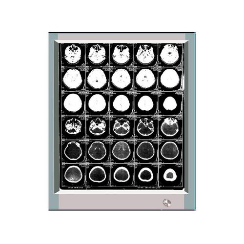 Negativoscopio 1 corpo - GP1001A - Bellamoon Medical - LED