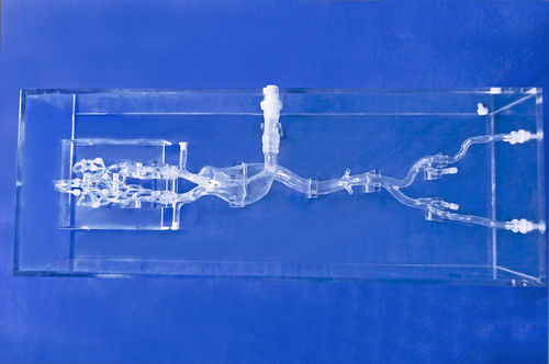 modello vascolare di vasi sanguigni - Trando 3D Medical Technology