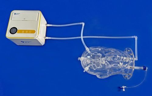 modello vascolare di vasi sanguigni - Trando 3D Medical Technology