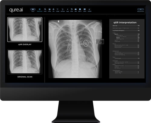 Software per reportistica - qXR - Qure.ai - di interpretazione / di rilevamento / per radiologia