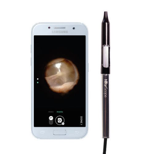 Videotoscopio con speculum - hearScope™ - hearX Group