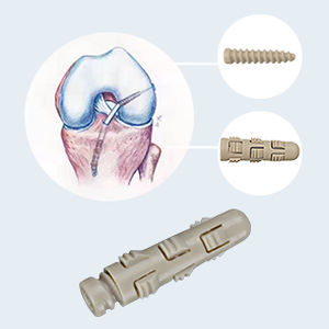 Vite ad interferenza legamento crociato anteriore - PSS-1 - Star Sports Medicine - non assorbibile