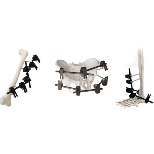 Fissatore esterno modulare - QuickX  - Zhejiang Borumon Biological Technology - tubolare / per adulti