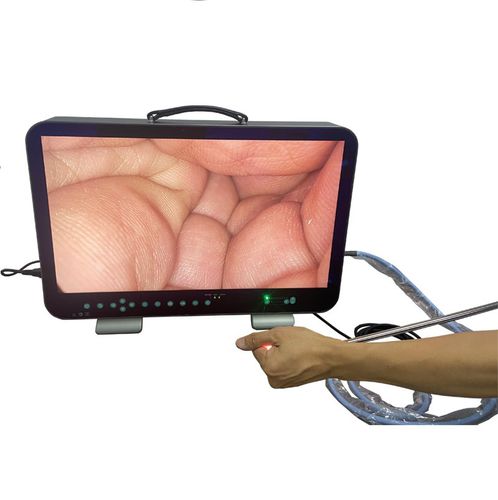 Fotocamera per endoscopio - E33 - Shantou Easywell Electronic Technologies - medica / chirurgica / digitale