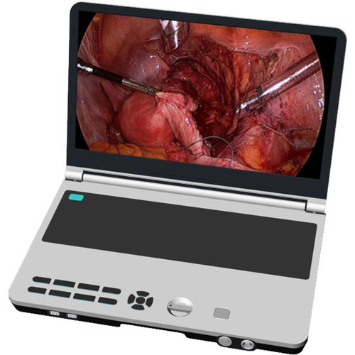 Fotocamera per endoscopio - N33 - Shantou Easywell Electronic Technologies - digitale / Full HD / 4K