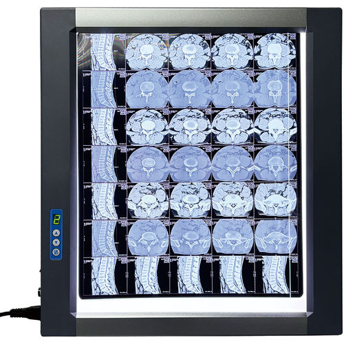 Negativoscopio LED - MST-4000I - Shantou Easywell Electronic Technologies - digitale / 1 corpo