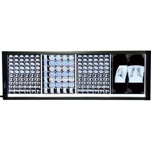 Negativoscopio digitale - MST-4000IV  - Shantou Easywell Electronic Technologies - 4 corpi / LED