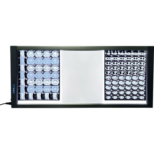 Negativoscopio digitale - MST-4000III - Shantou Easywell Electronic Technologies - 3 corpi / LED