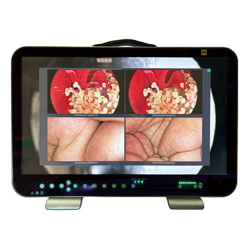 Videocamera per endoscopio - E43 - Shantou Easywell Electronic Technologies - odontoiatrica / veterinaria / di monitoraggio