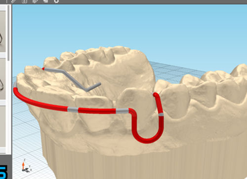 Software di fabbricazione - JawDraw® - Advanced Orthodontic Solutions  - odontoiatrico