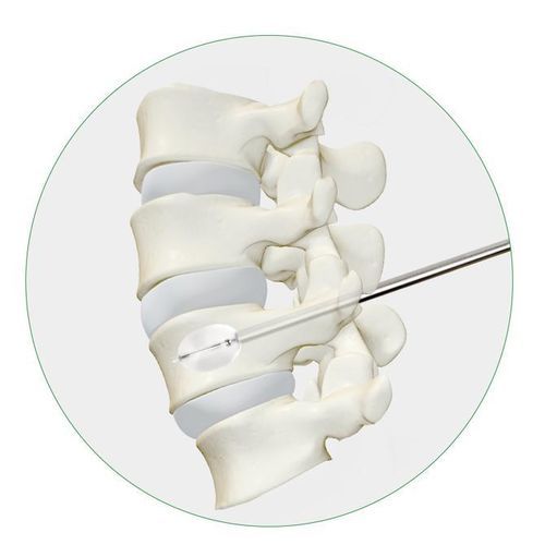Sistema di aumento vertebrale palloncino - Princeton Medical Scientific - per cifoplastica percutanea