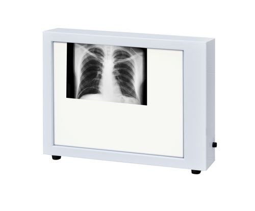 Negativoscopio 1 corpo - N-1 - Zapovit - verticale / LED
