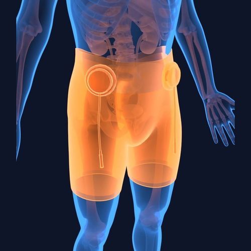 Software di trattamento - DataArt GmbH - medico / vescica