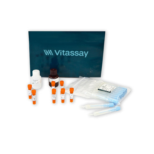Kit di test per malattie infiammatorie - VITASSAY HEALTHCARE S.L. - per antigene D / della calprotectina / al plasma