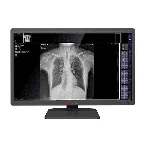 Monitor medico - MDS-C series - Shenzhen Juding Medical Equipment Co.,Ltd. - diagnostico / per diagnostica per immagini / per radiologia