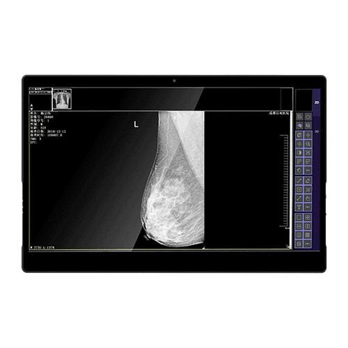 Monitor medico - IVS-8MP - Shenzhen Juding Medical Equipment Co.,Ltd. - diagnostico / per diagnostica per immagini / per mammografia
