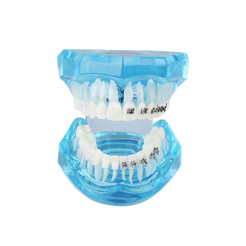 Modello anatomico di dentatura - UM-B21 - Tangshan UMG Medical Instrument - per ortodonzia / trasparente