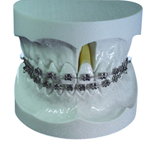 Modello anatomico di dentatura - UM-S11 - Tangshan UMG Medical Instrument - per ortodonzia / di dimostrazione