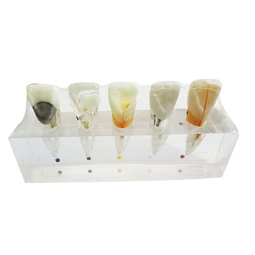 Modello Trasparente Di Cavità Pulpare Dei Denti 2 Pezzi Per - Foto 9