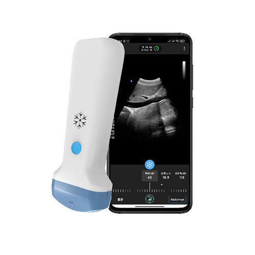 Ecografo palmare - S35C - Beijing iTrason Technologies - per ecografia ginecologica ed ostetrica / per ecografia addomino-pelvica / per ecografia in medicina d'emergenza