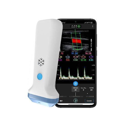 Ecografo palmare - S35L - Beijing iTrason Technologies - per ecografia in medicina d'emergenza / per ecografia del seno / per ecografia muscolo-scheletrica