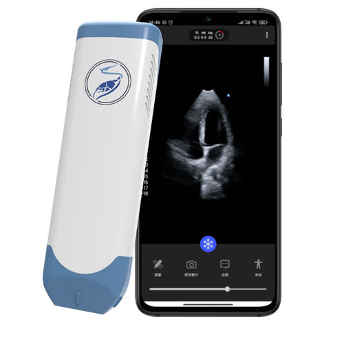 Ecografo palmare - Lite31P - Beijing iTrason Technologies - per ecografia cardiovascolare / in bianco e nero / doppler spettrale