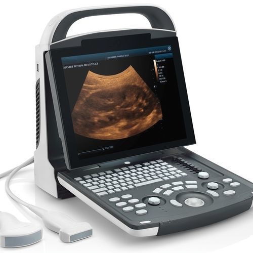 Ecografo portatile - DP10 - Beijing iTrason Technologies - per ecografia multidisciplinare / per ecografia ginecologica ed ostetrica / per ecografia addomino-pelvica