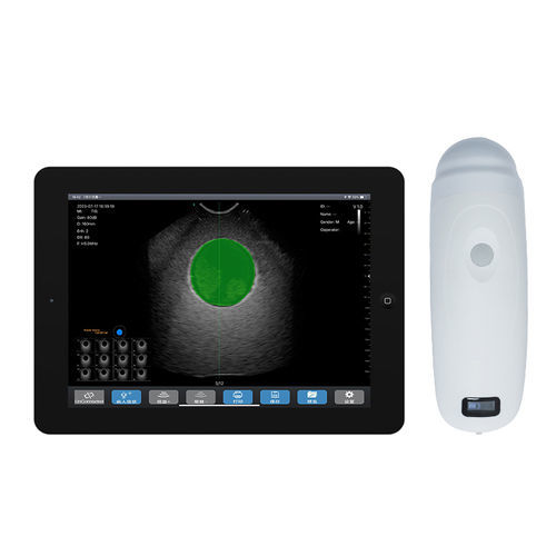 Scanner vescicale portatile - BS2 - Beijing iTrason Technologies