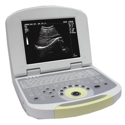 Ecografo portatile - 6600 B - Mianyang Sonic Electronic - per ecografia multidisciplinare / in bianco e nero / con console integrata
