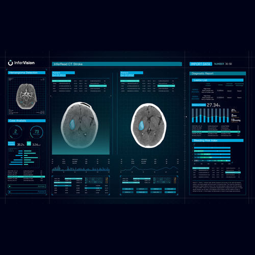 Software di gestione delle allerte - CT Stroke - Beijing Infervision Technology Co. Ltd. - di trattamento / per identificazione di varianti / medico