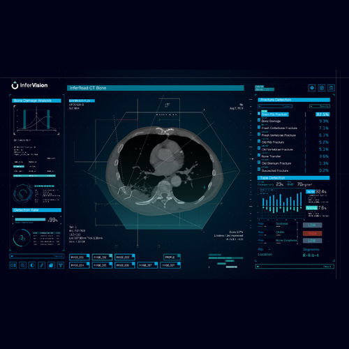 Software di analisi - Bone - Beijing Infervision Technology Co. Ltd. - di analisi delle immagini / di rilevamento / medico