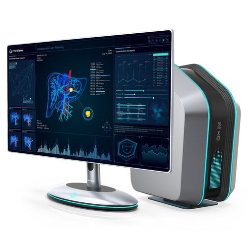 Software medico - InferOperate® Suite  - Beijing Infervision Technology Co. Ltd. - chirurgico / clinico / di visualizzazione