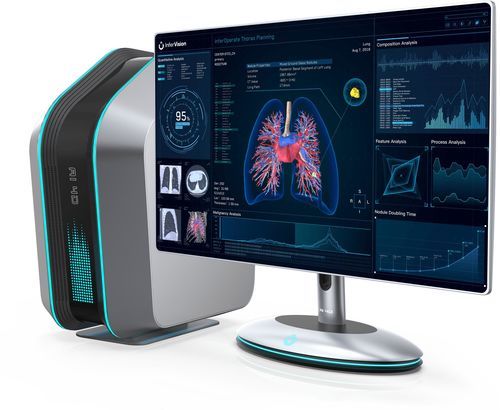 Software medico - InferOperate® - Beijing Infervision Technology Co. Ltd. - per chirurgia / chirurgico / clinico