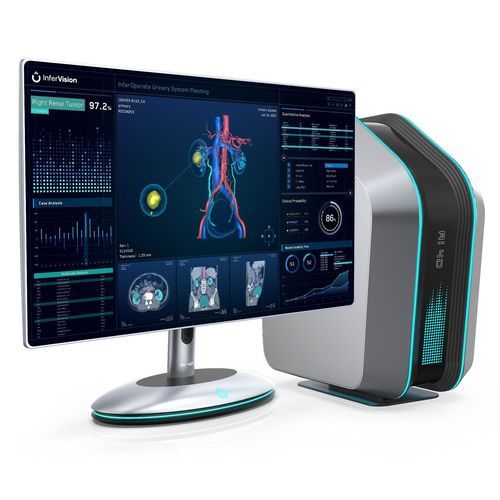 Software preoperatorio - InferOperate® Suite - Beijing Infervision Technology Co. Ltd. - urologia / per chirurgia / di rilevamento dei contorni
