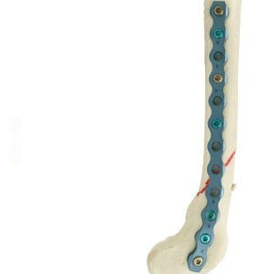 Placca ossea di compressione a uso veterinario - PRCL - Anhui Bailu Small Animal Orthopedic Instrument