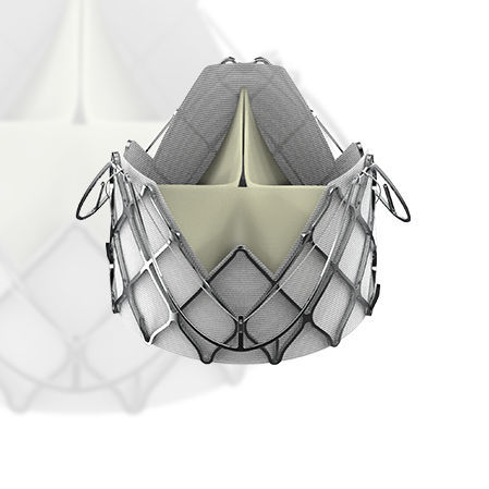 Bioprotesi valvolare aortica - J-Valve™ - Suzhou Jiecheng Medical Technology - in tessuto porcino / in nitinol / senza suture