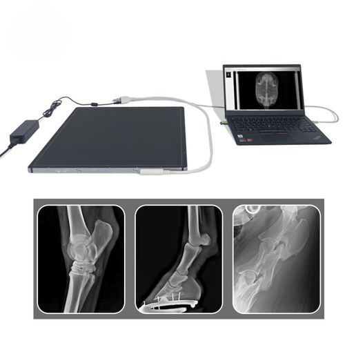 Rilevatore a pannello piatto per radiografia multidisciplinare - FTLFPD-V1717X - Fatali Medical - portatile / 17 x 17