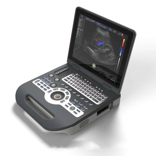 Ecografo portatile - FTL-UTS1600 - Fatali Medical - per ecografia ginecologica ed ostetrica / per ecografia addomino-pelvica / con doppler a colori